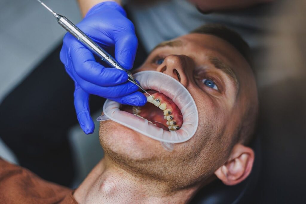 Signs You Should See an Orthodontist