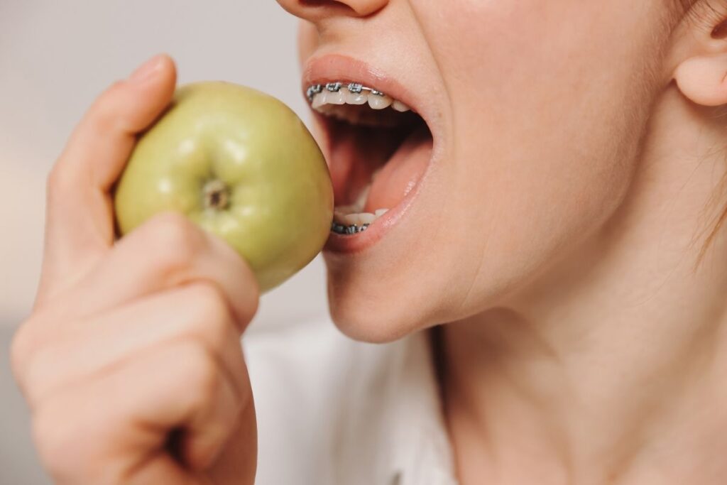 when to eat after getting braces