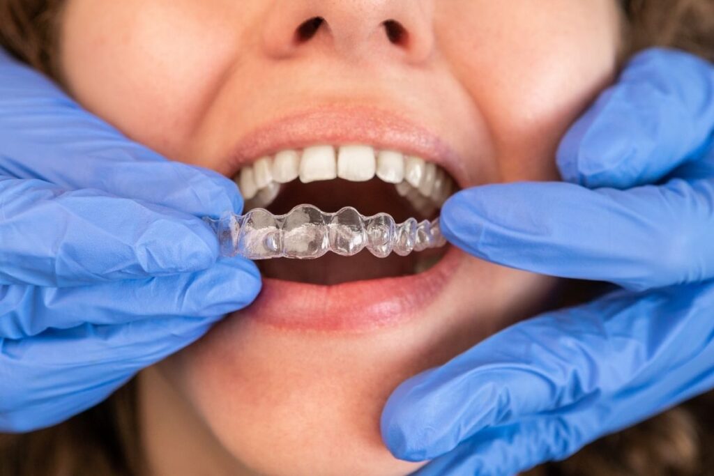 Is Invisalign Safe With Gum Disease or Bone Loss